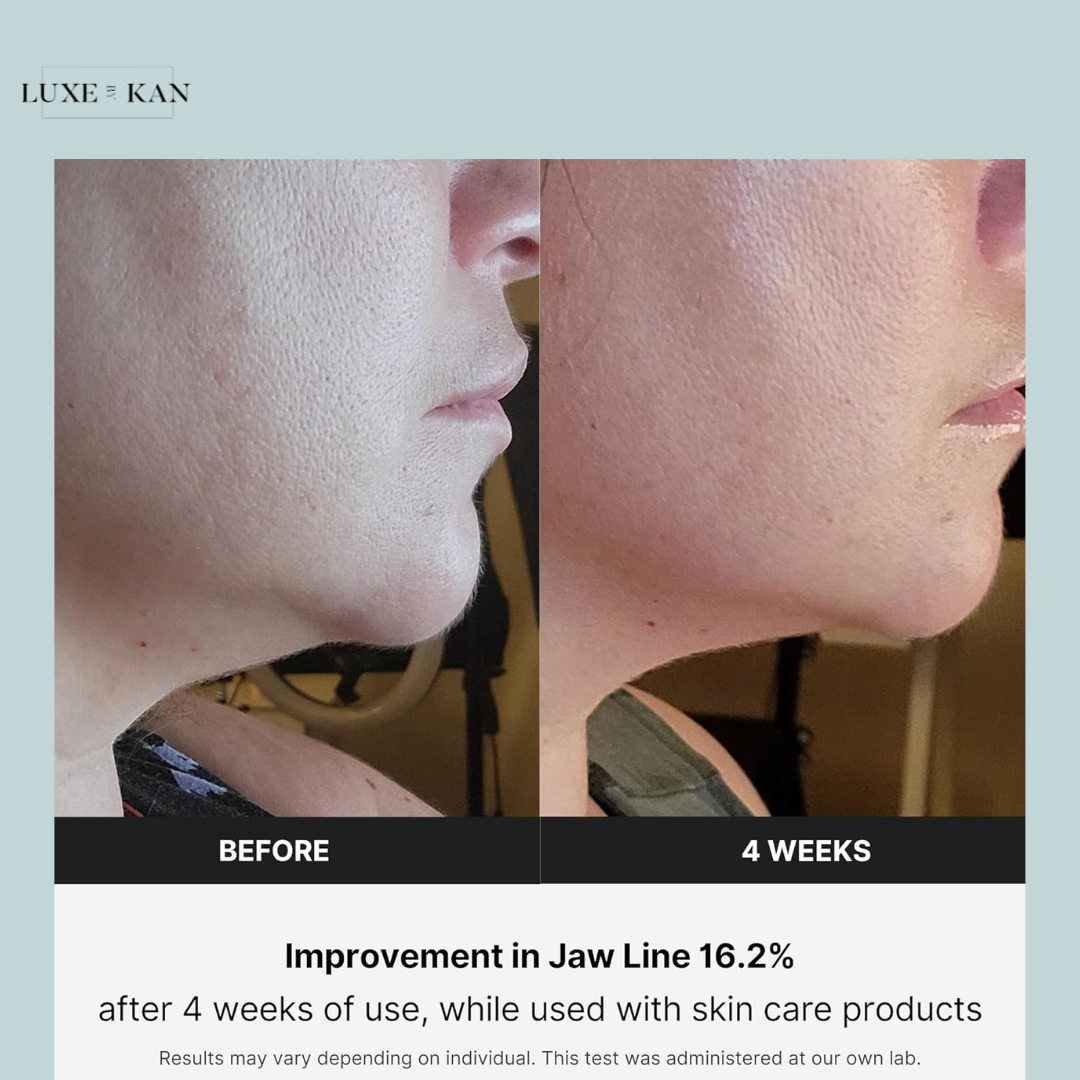 Medicube Age-R Derma EMS Shot - Facial Contouring