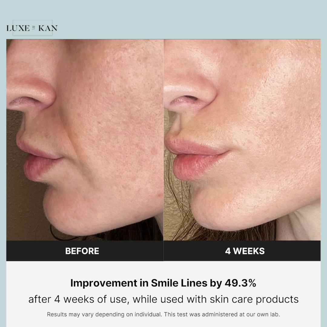 Medicube Age-R Derma EMS Shot - Facial Contouring