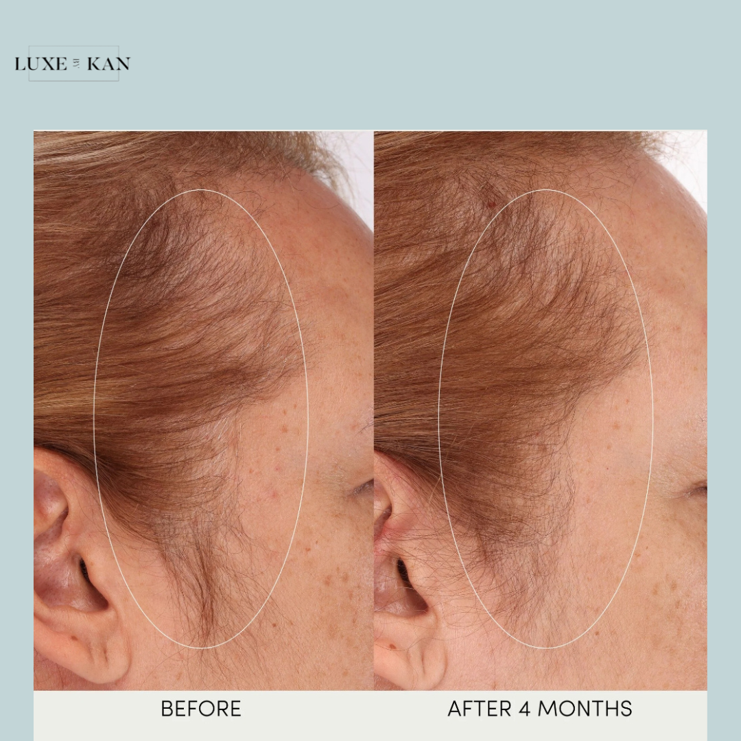 OUAI SCALP SERUM 50ML