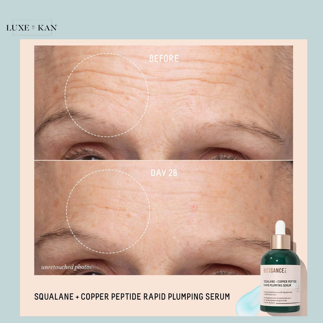 A skincare product display featuring before-and-after images showcasing skin improvement, with a cosmetic bottle on the right side.