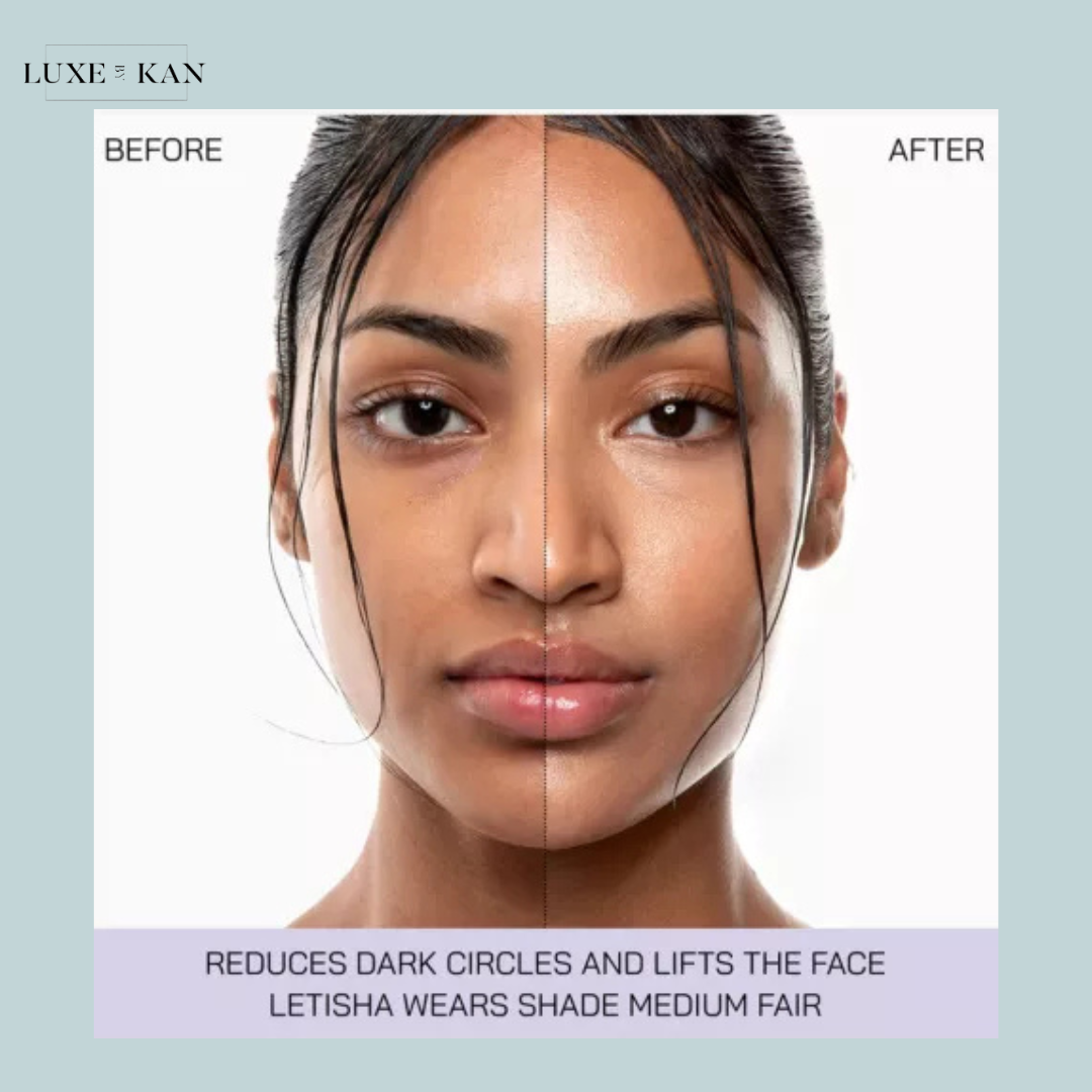 Before-and-after comparison highlighting the effects of a cosmetic treatment that reduces dark circles and lifts the face.