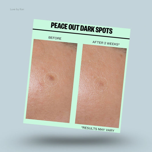 Close-up comparison: a dark spot circled on skin before and after treatment. The second image shows the dark spot is diminished. Text reads, "Peace Out Dark Spots. Results may vary."