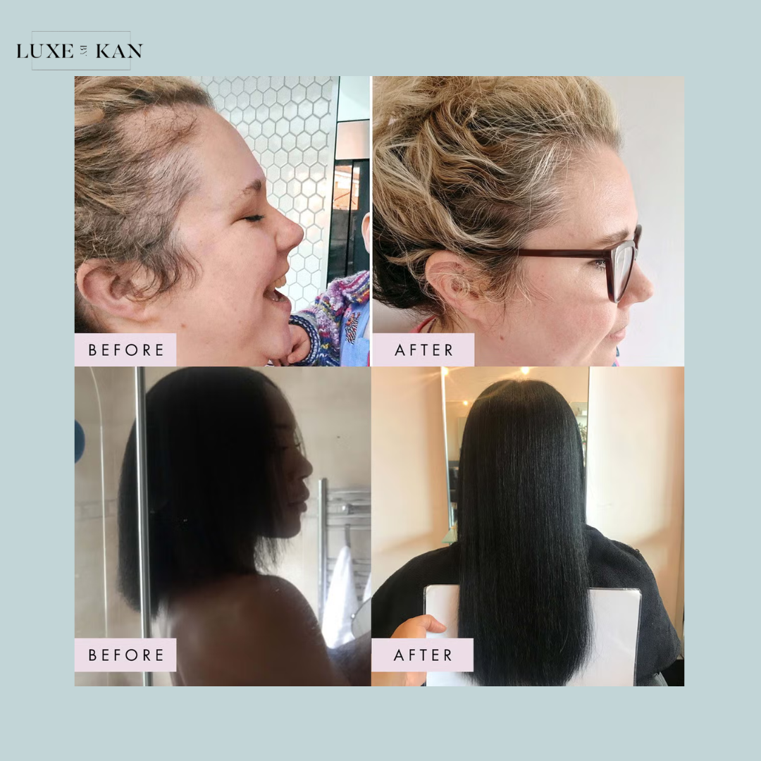 Hair Gain Capsules - 60 Capsules