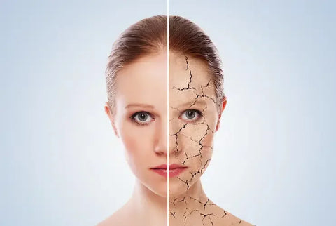 Dry Skin vs Dehydrated Skin: Understand the Difference & What to Use