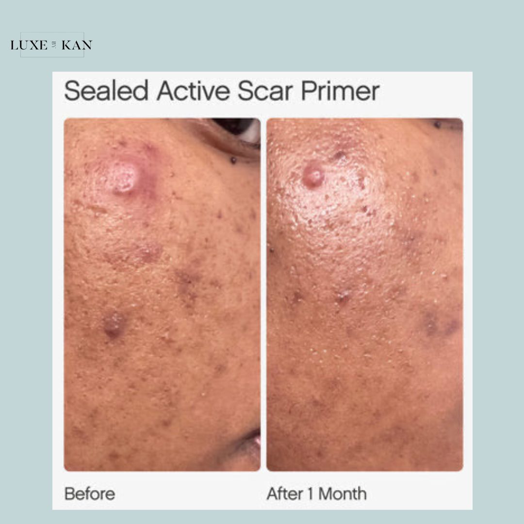 Topicals Sealed Active Scar Primer 28ml