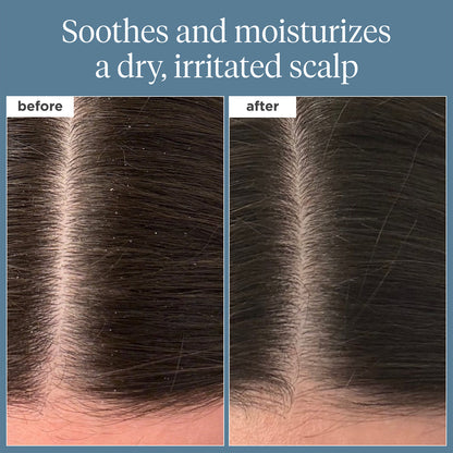 Briogeo
Scalp Revival Rosemary Pre-Wash Scalp and Hair Oil