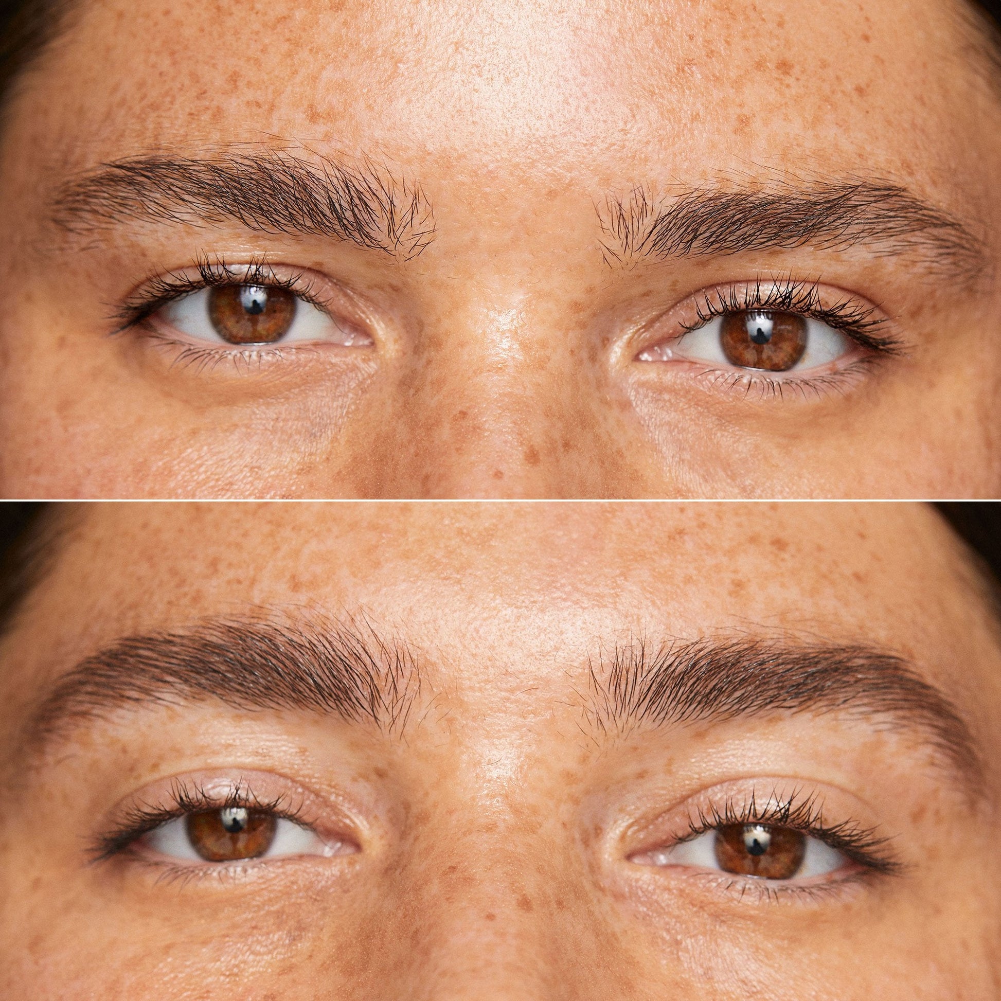 Close-up of a person's forehead showing a smooth skin texture with light freckles and a natural glow.