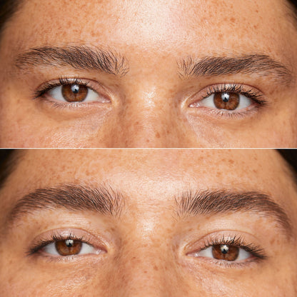 Close-up of a person's forehead showing a smooth skin texture with light freckles and a natural glow.