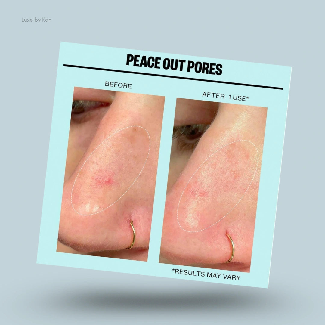 Before and after images of a nose, purportedly showing reduced pore size after one use of a product.