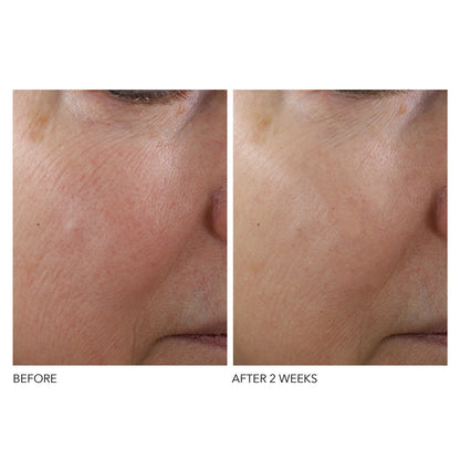 Dr Dennis Gross Advanced Retinol + Ferulic Overnight Texture Renewal Peel